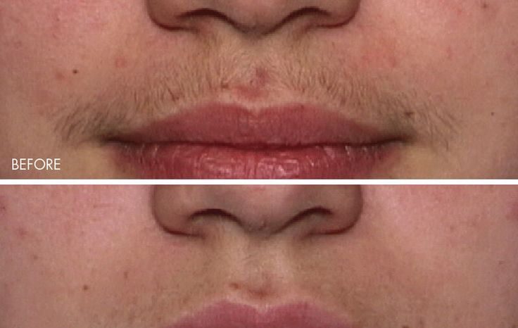 Coral Laser clinic johar Town Coral Laser clinic johar Town